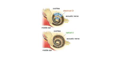 Electrical vs Optical Choclea stimulation, Fraunhofer IPMS, Max Planck